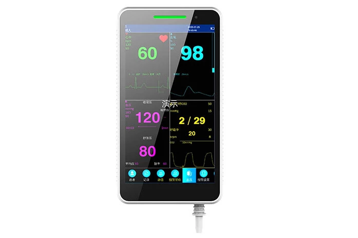 Rural Clinic's Experience with the Handheld Patient Monitor